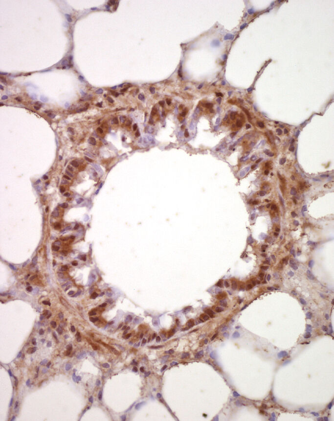 Pedro del Hierro Man & Woman